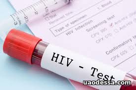 Показатели диагностики и лечения ВИЧ-инфекции в Одессе улучшились