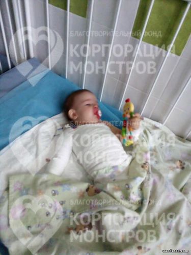 В Одессе в больницу попала 11-летняя девочка с 25% ожогов тела
